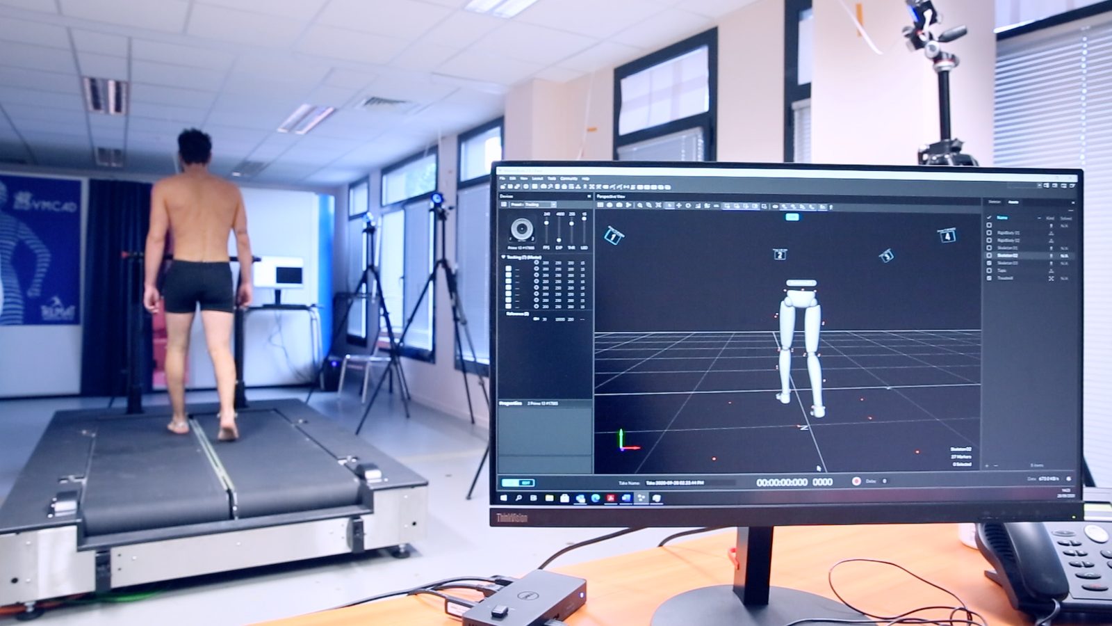 A person walking on an instrumented treadmill in a movement analysis laboratory, surrounded by motion capture cameras on tripods, while a monitor in the foreground shows a three dimensional skeletal reconstruction of the legs