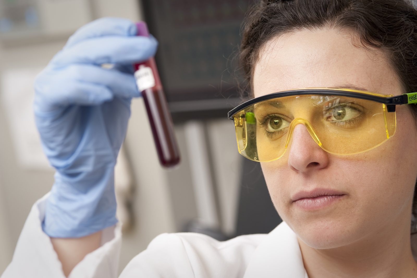 A scientist in a laboratory checking a blood sample against light