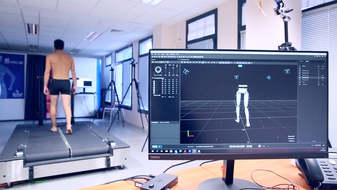 A person walking on an instrumented treadmill in a movement analysis laboratory, surrounded by motion capture cameras