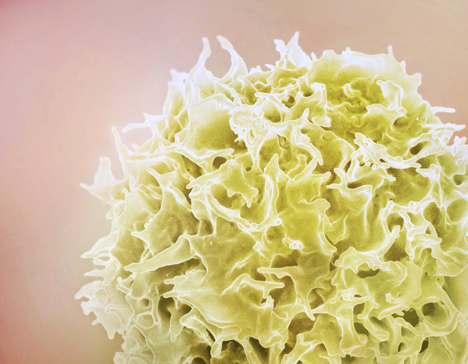 A colorized scanning electron micrograph of a human T lymphocyte, showing its ruffled, textured cell surface in gold against a soft pink background
